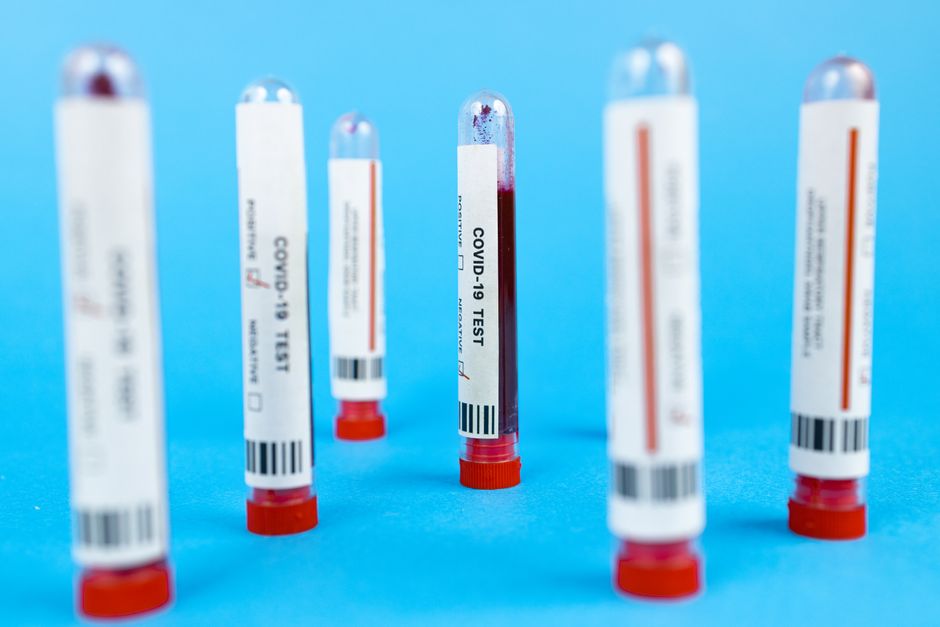 Anticuerpos monoclonales: Así funciona el tratamiento sin factor que revolucionó el manejo de la hemofilia A.
